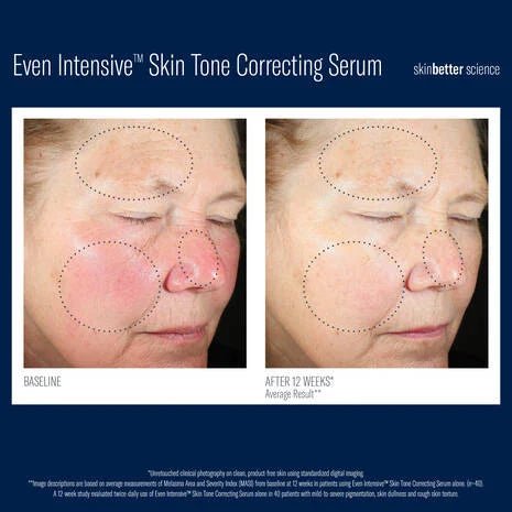 Even Intensive Skin Tone Correcting Serum - Espace Skins Montreal