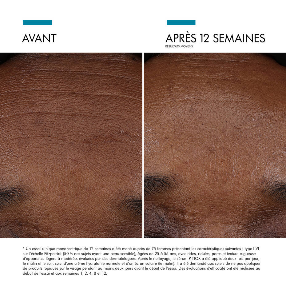 SkinCeuticals - P - TIOX - Espace Skins Montreal