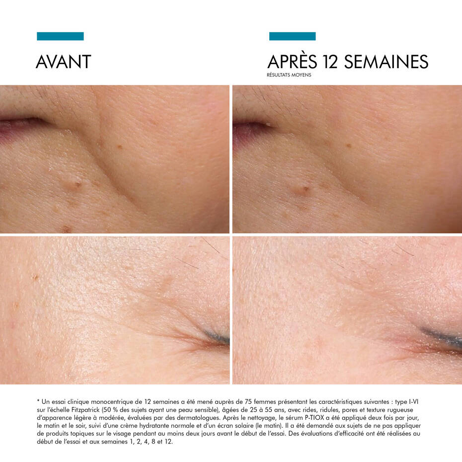 SkinCeuticals - P - TIOX - Espace Skins Montreal