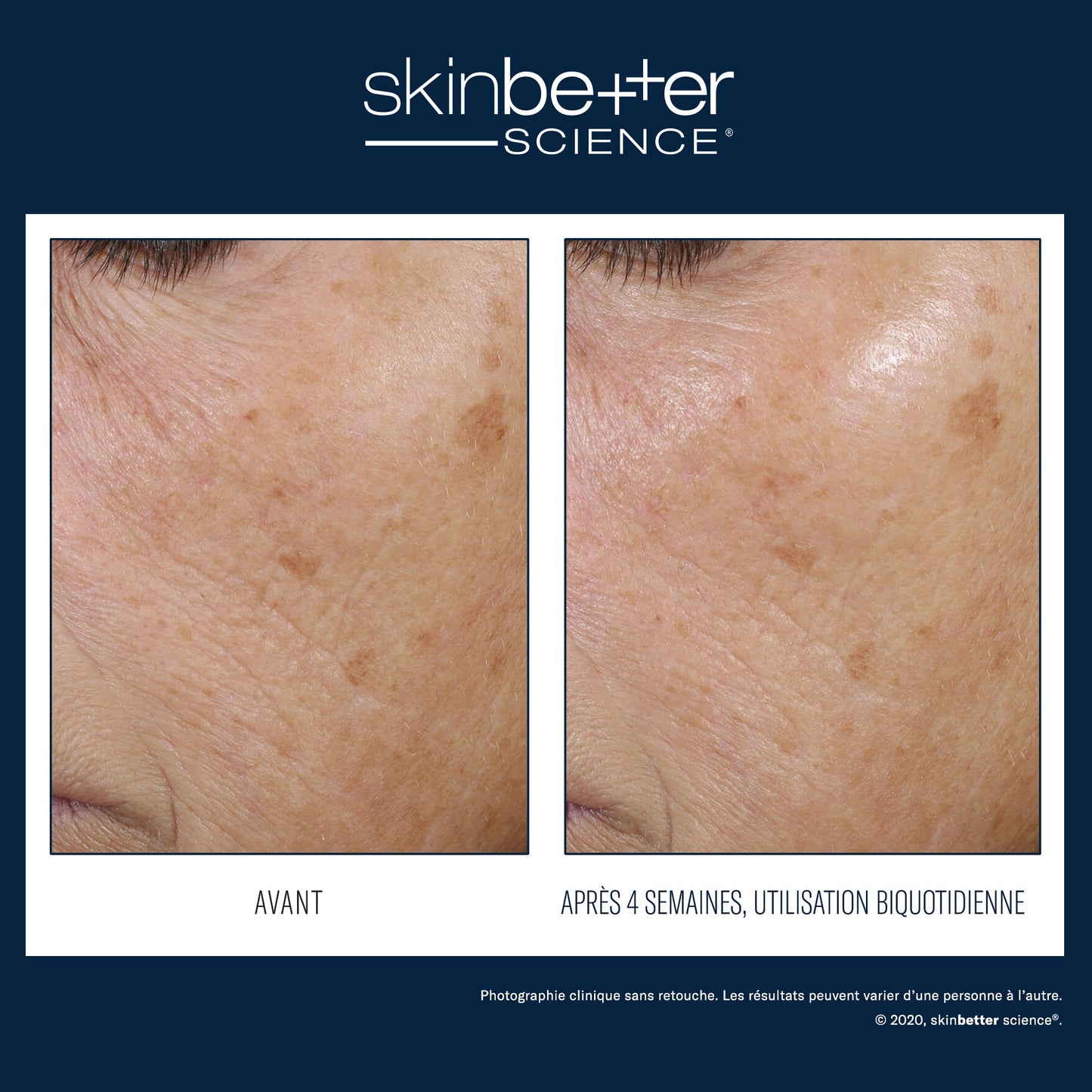 Trio Rebalancing Moisture Treatment 50ml - Espace Skins Montreal