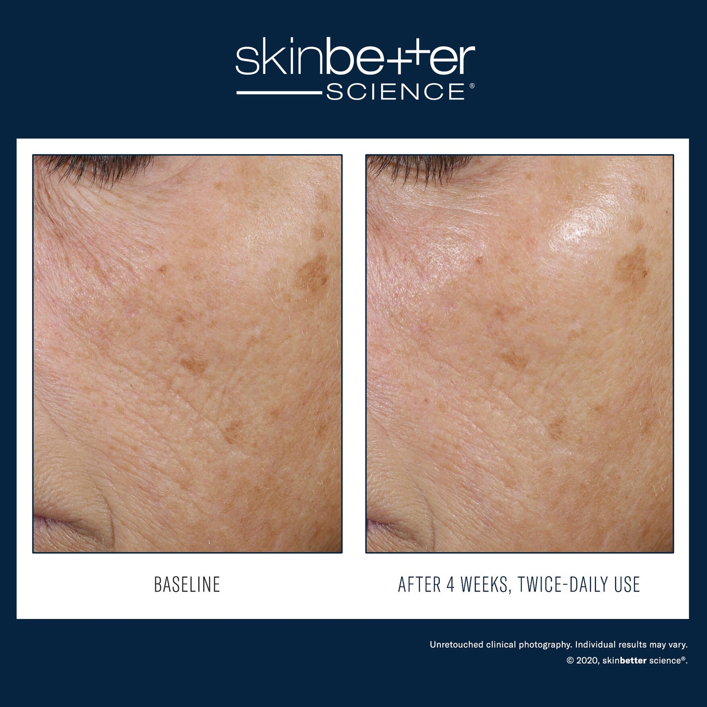 Trio Rebalancing Moisture Treatment 50ml - Espace Skins Montreal