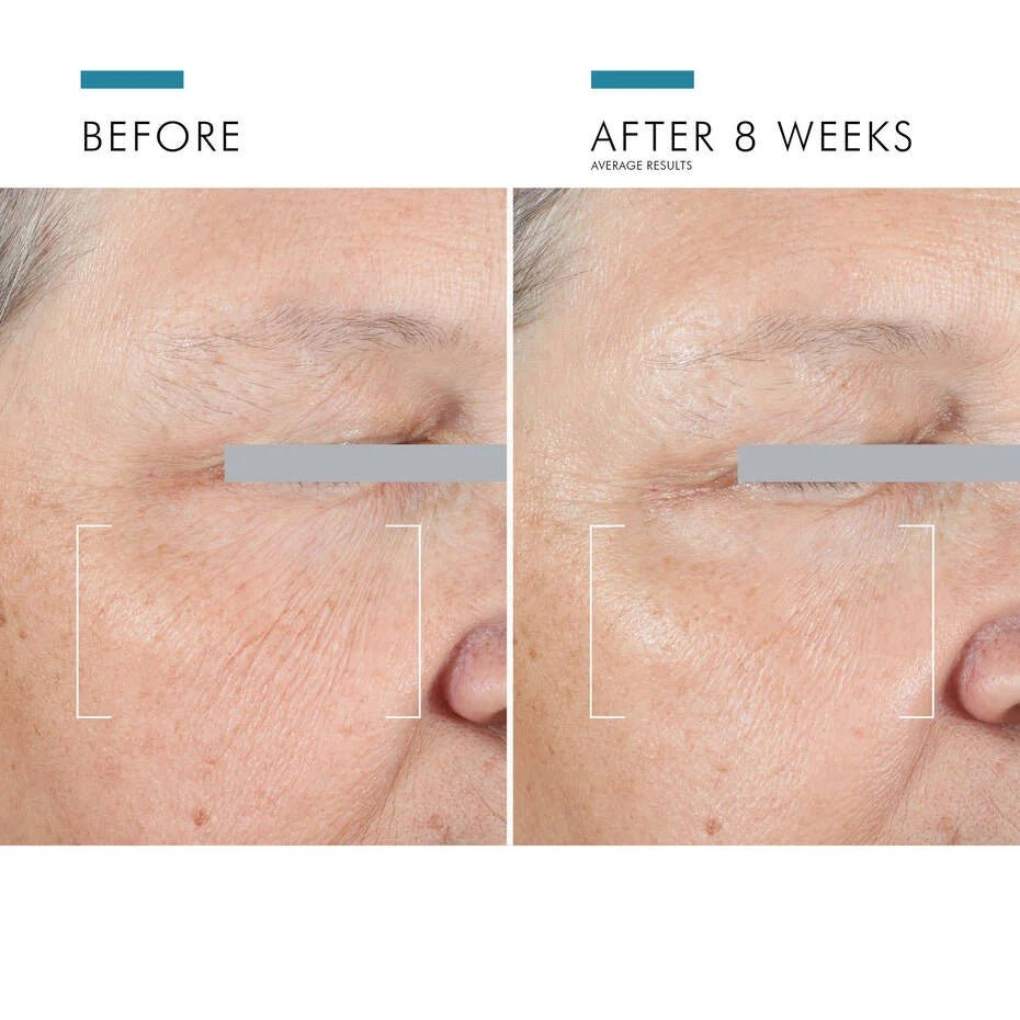 SkinCeuticals - A.G.E. ADVANCED EYE FOR DARK CIRCLES - Espace Skins Montreal