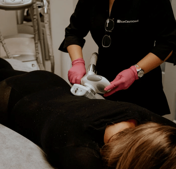 Defeat Cellulite with Lipomassage: The Effective Solution in Montreal - Espace Skins Montreal