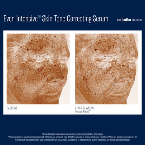 Even Intensive Skin Tone Correcting Serum - Espace Skins Montreal