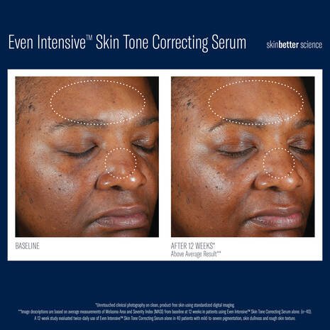 Even Intensive Skin Tone Correcting Serum - Espace Skins Montreal